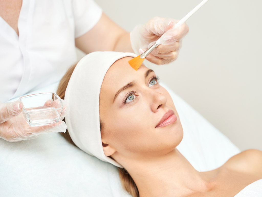 Chemical Peel