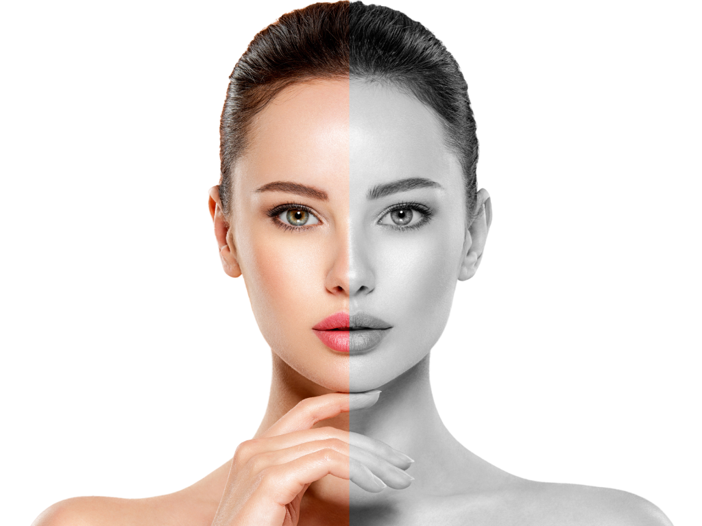 MICRONEEDLING AND SERUM